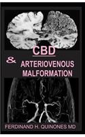 CBD & Arteriovenous Malformation