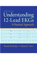Understanding 12-Lead EKGs