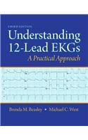 Understanding 12-Lead EKGs: A Practical Approach