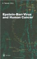 Epstein-Barr Virus and Human Cancer