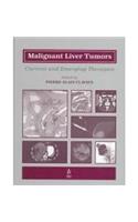 Malignant Liver Tumors
