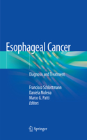 Esophageal Cancer