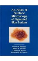 Atlas of the Surface Microscopy of Pigmented Skin Tumours