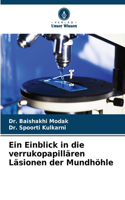 Einblick in die verrukopapillären Läsionen der Mundhöhle