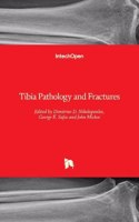 Tibia Pathology and Fractures