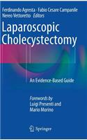 Laparoscopic Cholecystectomy