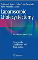 Laparoscopic Cholecystectomy