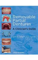 Removable Partial Dentures