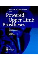 Powered Upper Limb Prostheses