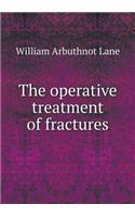 The operative treatment of fractures: (English)