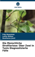 Menschliche Dirofilariose
