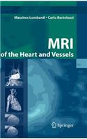 MRI of the Heart and Vessels