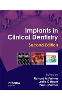 Implants in Clinical Dentistry