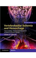 Vertebrobasilar Ischemia and Hemorrhage