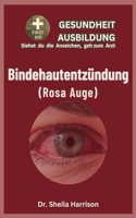 Bindehautentzündung (rosa Auge)