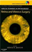 Retina and Vitreous Surgery