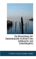 Die Anwendung Der Galvanokaustik Im Innern Des Kehlkopfes Und Schlundkopfes
