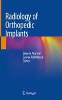 Radiology of Orthopedic Implants