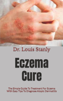 Eczema Cure: The Simple Guide To Treatment For Eczema With Easy Tips To Diagnose Atopic Dermatitis
