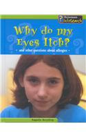 Why Do My Eyes Itch?