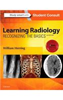 Learning Radiology: Recognizing the Basics