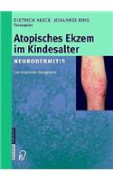 Atopisches Ekzem Im Kindesalter (Neurodermitis)