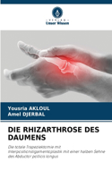 Rhizarthrose Des Daumens
