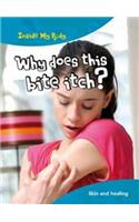 Why does this Bite Itch?: (Inside My Body)