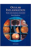 Ocular Inflammation
