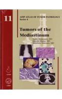 Tumors of the Mediastinum