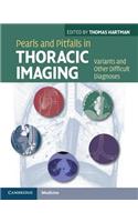 Pearls and Pitfalls in Thoracic Imaging: Variants and Other Difficult Diagnoses