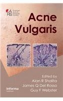 Acne Vulgaris