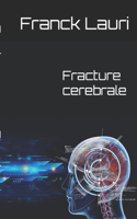 Fracture cerebrale