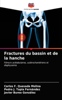 Fractures du bassin et de la hanche