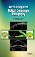 Anterior Segment Optical Coherence Tomography