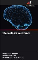 Stereotassi cerebrale