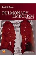 Pulmonary Embolism