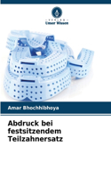 Abdruck bei festsitzendem Teilzahnersatz