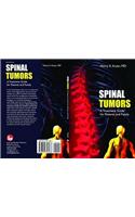 Spinal Tumors: A Treatment Guide for Patients and Family: A Treatment Guide for Patients and Family