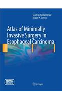 Atlas of Minimally Invasive Surgery in Esophageal Carcinoma