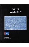 Skin Cancer: A Volume in the American Cancer Society Atlas of Clinical Oncology Series