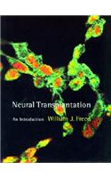 Neural Transplantation: An Introduction