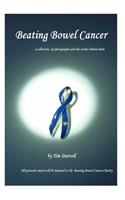 Beating Bowel Cancer