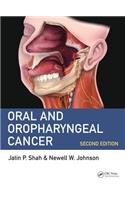 Oral and Oropharyngeal Cancer