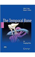 Temporal Bone