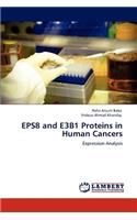 Eps8 and E3b1 Proteins in Human Cancers