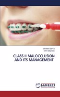 Class II Malocclusion and Its Management