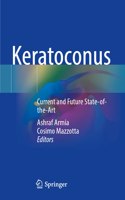 Keratoconus