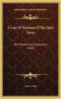 A Case Of Neuroma Of The Optic Nerve