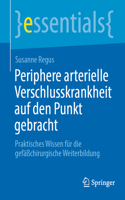 Periphere Arterielle Verschlusskrankheit Auf Den Punkt Gebracht